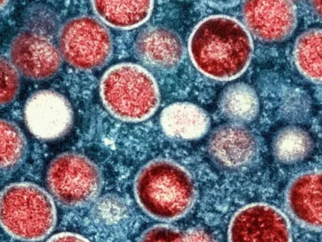 a colorised transmission electron micrograph of mpox particles in red found within an infected cell in blue photo aljazeera a colorised transmission electron micrograph of mpox particles in red found within an infected cell in blue photo aljazeera
